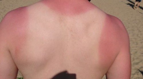 20170527_205325326_iOS